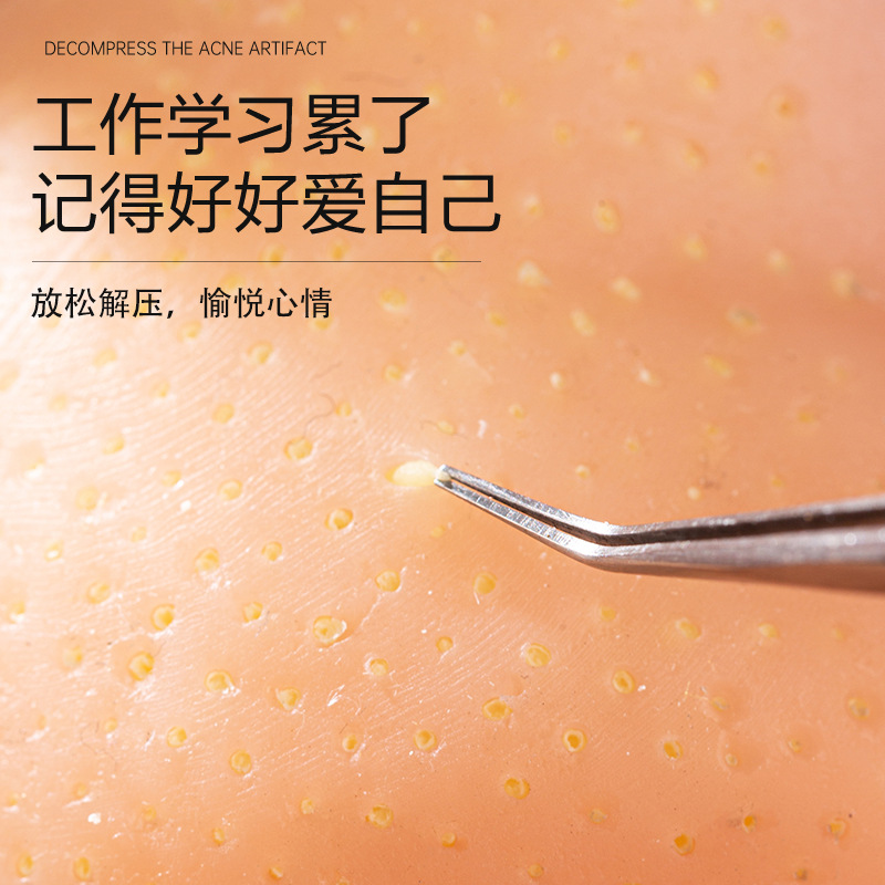 Stress relief, pimple squeeze, - Dolls 评论和价格